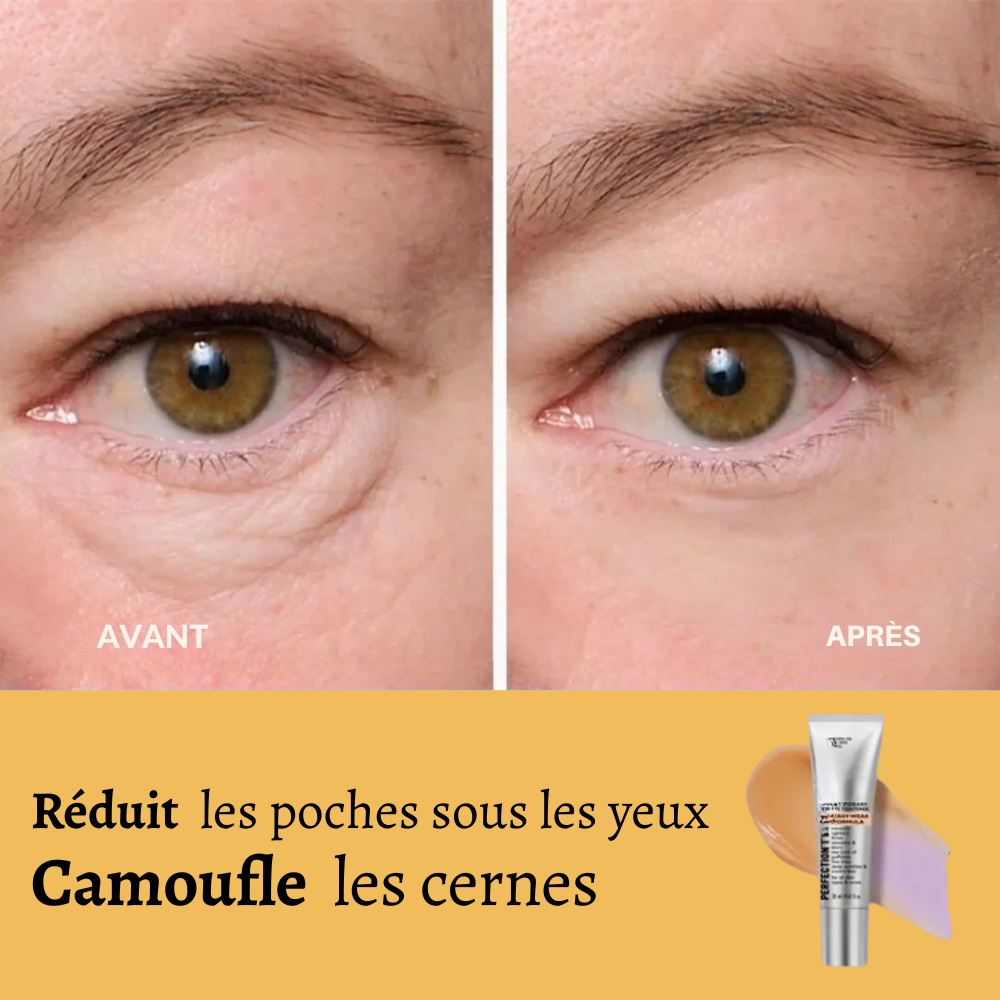 GlowLift®⏐Anti Cerne