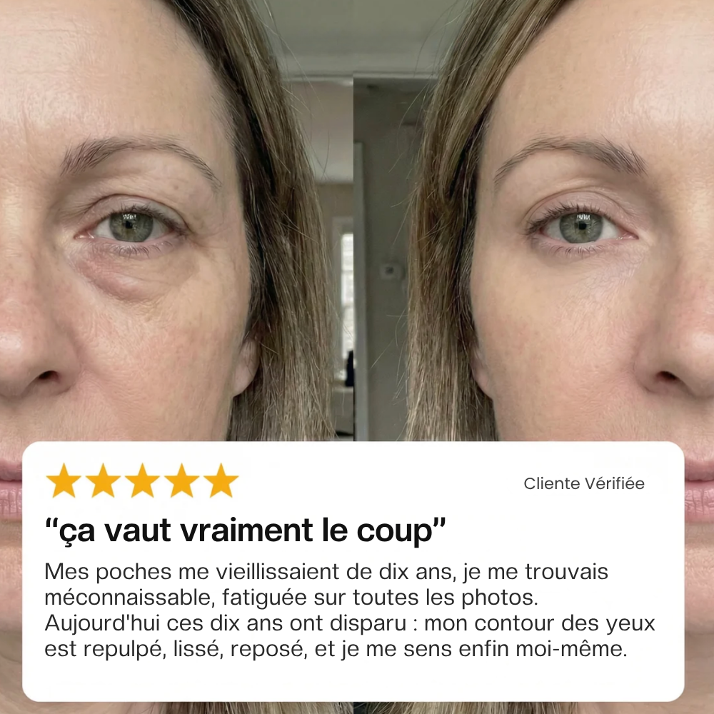 GlowLift⏐Anti Cerne
