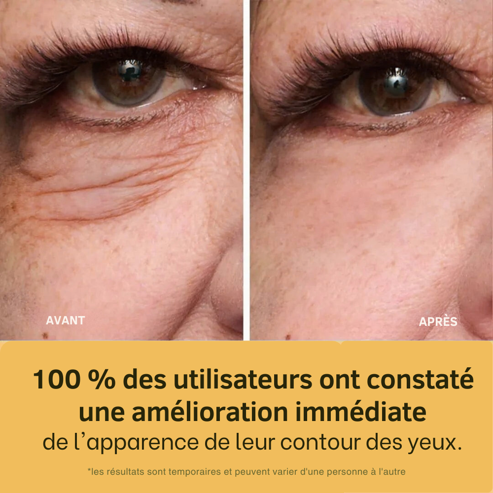 GlowLift®⏐Anti Cerne