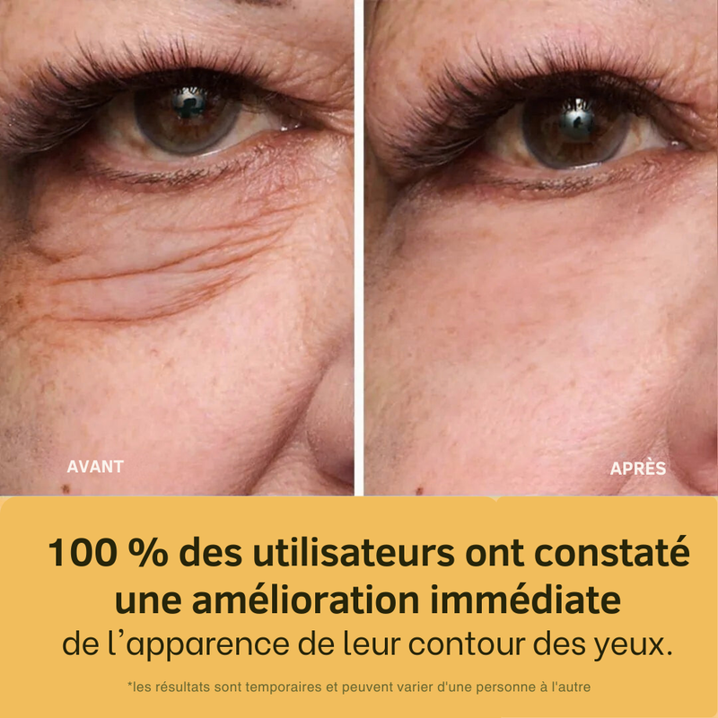 GlowLift⏐Anti Cerne